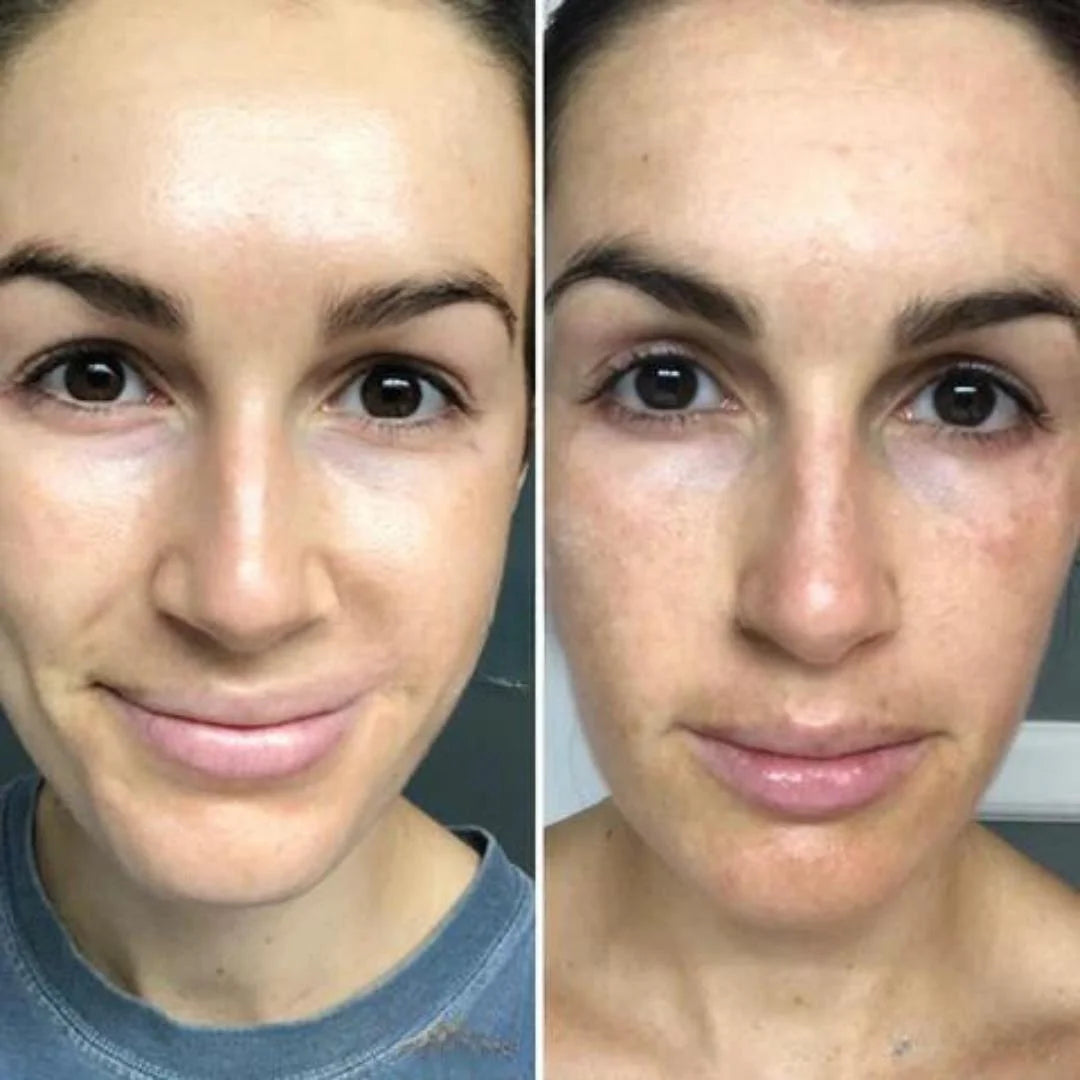 Creme facial com 1% de retinol – antirrugas, hidratante e suave