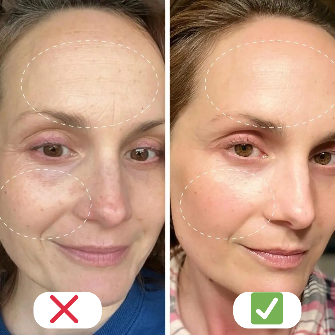 Creme facial com 1% de retinol – antirrugas, hidratante e suave